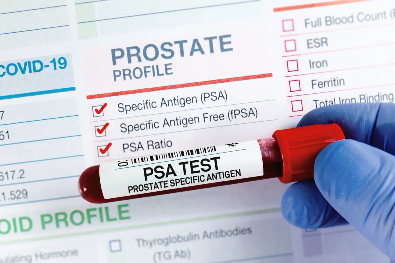What is a PSA Test ?